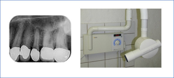 Helio-Dent Röntgengerät für Einzelbilder